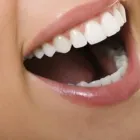 La imagen 1 de la Empresa BOLÍVAR VALENZUELA (CLINICA SAN DAMIAN) Parkinson en Las Condes RM