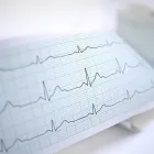 La imagen 4 de la Empresa CARDIOCENTRO CHILLÁN LTDA. TESTS DE ESFUERZO en Chillan BI