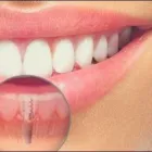 La imagen 3 de la Empresa CLINICA OHIGGINS SALUD Implantologias en Quilicura RM