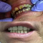 La imagen 1 de la Empresa CONSULTA VIDADENTRYG Dentistas Prótesis en Santiago RM