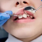 La imagen 11 de la Empresa DENTAL WHITE ODONTOLOGÍA Y ESTÉTICA Ortodoncia en Quilpué VS