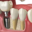 La imagen 13 de la Empresa DENTAL WHITE ODONTOLOGÍA Y ESTÉTICA Ortodoncia en Quilpué VS