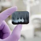 La imagen 2 de la Empresa DENTISTA ANA ORTEGA Tratamientos Dentales en Ovalle CO
