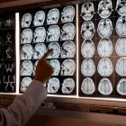 La imagen 1 de la Empresa DR. EDUARDO CHACÓN G. VELOCIDAD DE CONDUCCION en Viña del Mar VS