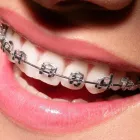 La imagen 5 de la Empresa DRA. KAREM PANTOJA V. TRATAMIENTO DE BRACKETS en Concepción BI