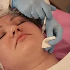 La imagen 3 de la Empresa DRA. MARÍA ANGELA SIRI BRIGANTI Dermatologia en Valparaíso VS