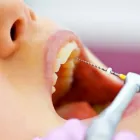 La imagen 2 de la Empresa IMEDENT Odontologia en Viña del Mar VS