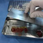 La imagen 4 de la Empresa PLASMA SALUD Plasma Rico en Plaquetas en Santiago RM