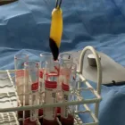 La imagen 8 de la Empresa PLASMA SALUD Plasma Rico en Plaquetas en Santiago RM