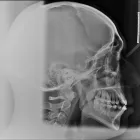 La imagen 1 de la Empresa RXDENT Radiologia en Valparaíso VS