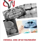 La imagen 3 de la Empresa RXDENT Radiologia en Valparaíso VS