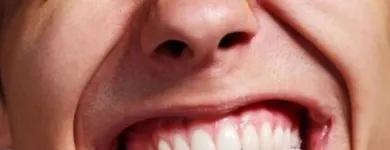 La imagen 2 de la Empresa BOLÍVAR VALENZUELA (CLINICA SAN DAMIAN) Parkinson en Las Condes RM