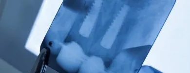 La imagen 6 de la Empresa CLÍNICA VITALIS Urgencias Dentales en Viña del Mar VS