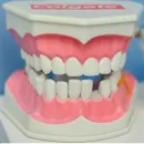 CLÍNICA DENTAL AMANCAY Ortodoncia en La Florida RM