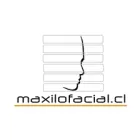 MAXILOFACIAL